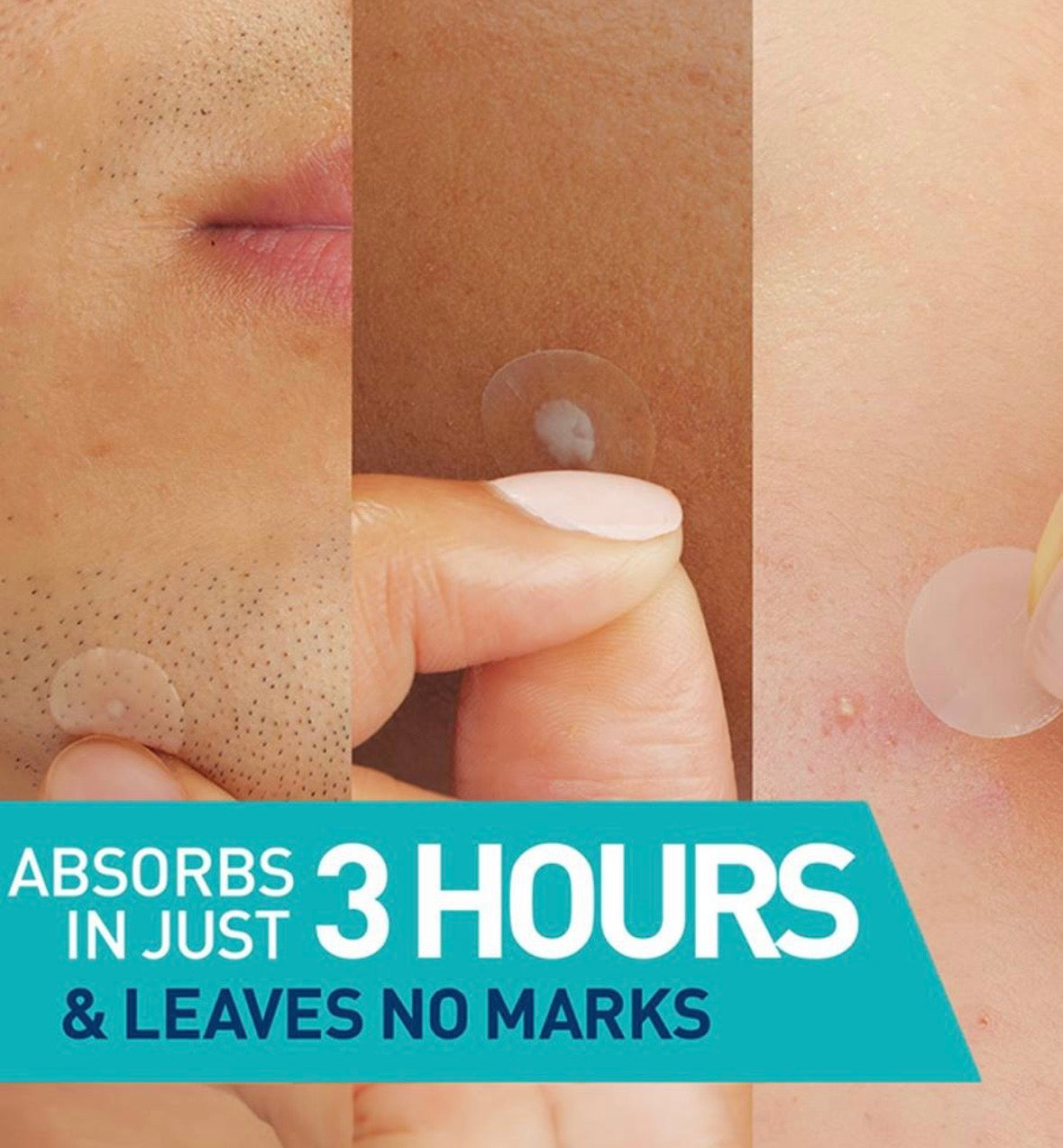 CeraVe Blemish Barrier Patches