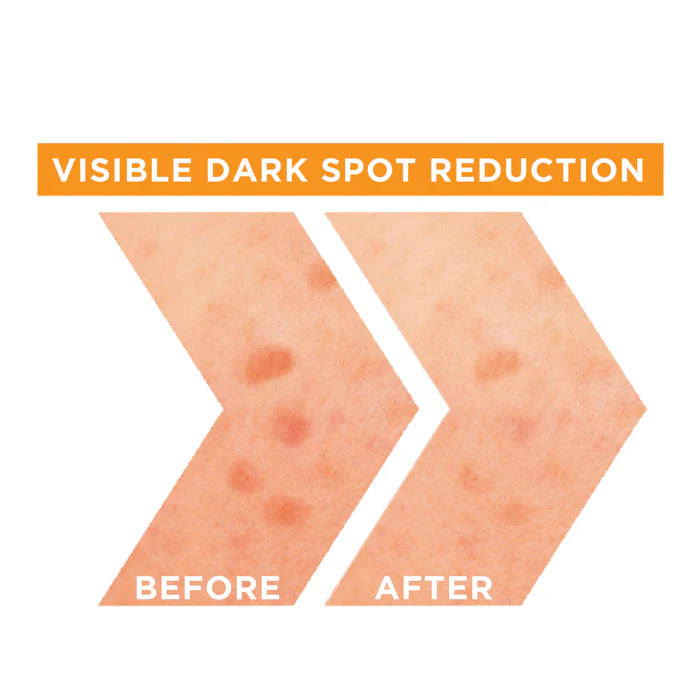 Garnier Fast Bright Vitamin C Booster Serum
