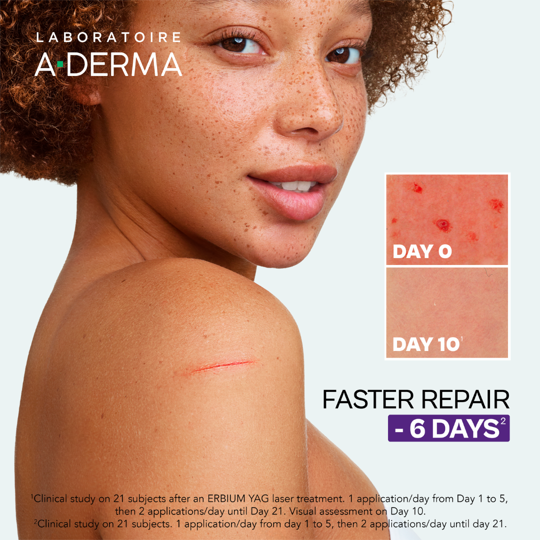 A-Derma Epitheliale AH Ultra Anti-mark Repairing Cream And A-Derma Oat Rhealba Hand Cream Buy 1 Get 1 Pouch Bundle