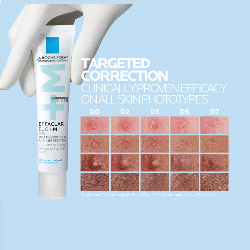 La Roche-Posay Effaclar Duo+ M – Acne Treatment & Oil Control for Oily, Acne-Prone Skin