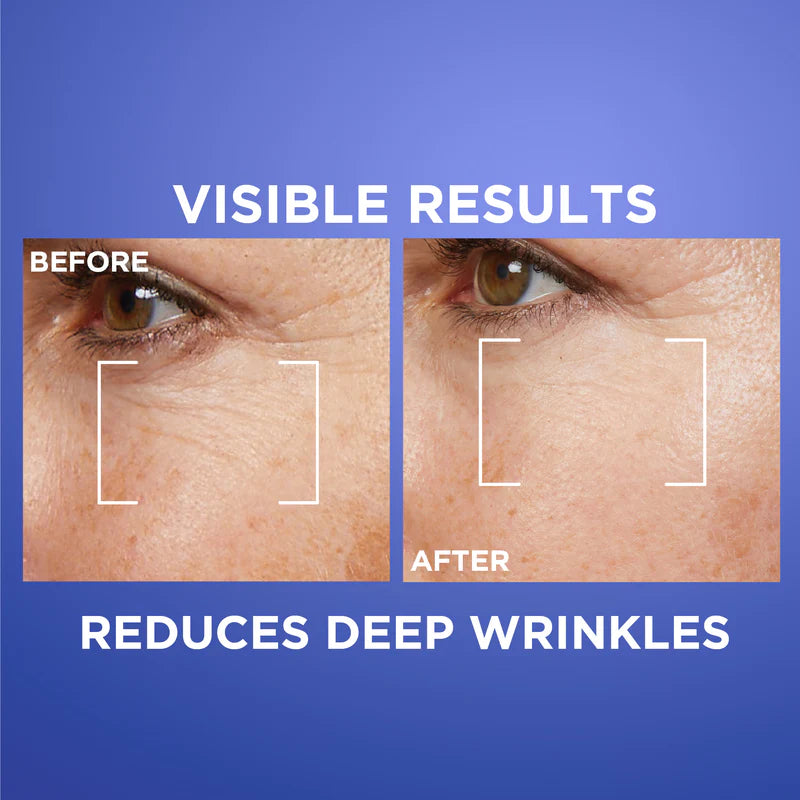 L'Oréal Paris Revitalift Retinol Night Serum – Anti-Aging Face Serum with 0.2% Pure Retino